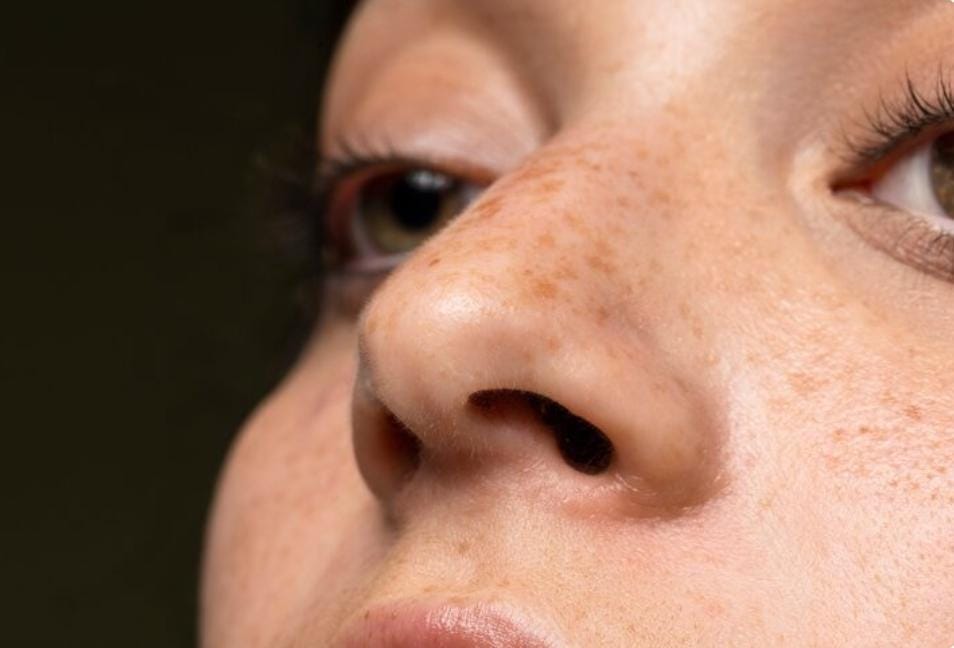 Cara Alami Mengurangi Flek Hitam dengan Chia Seed, Susu, dan Tepung Beras