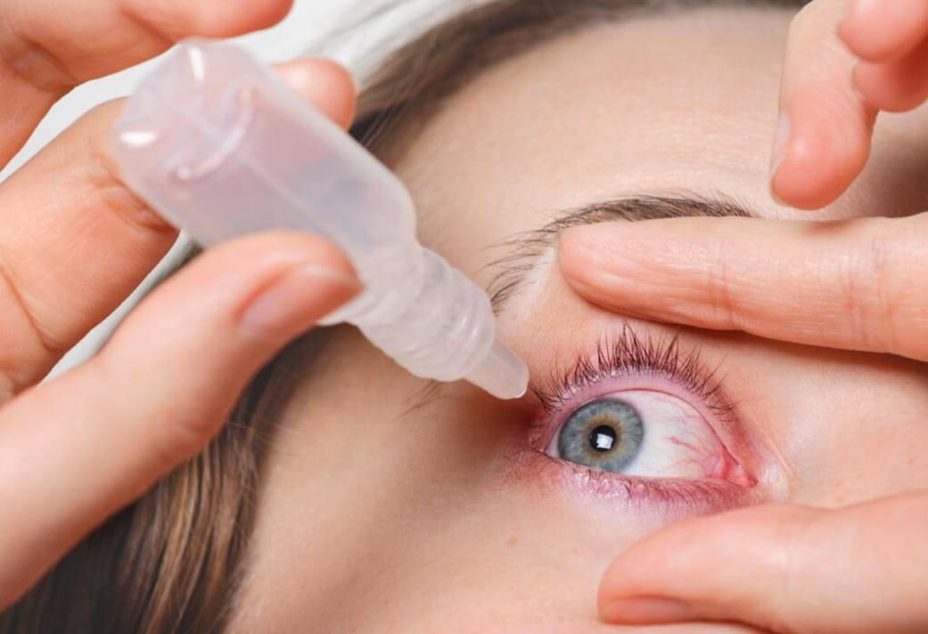 Irigasi Mata: Panduan Lengkap Membersihkan Mata dari Debu dan Iritasi Secara Aman