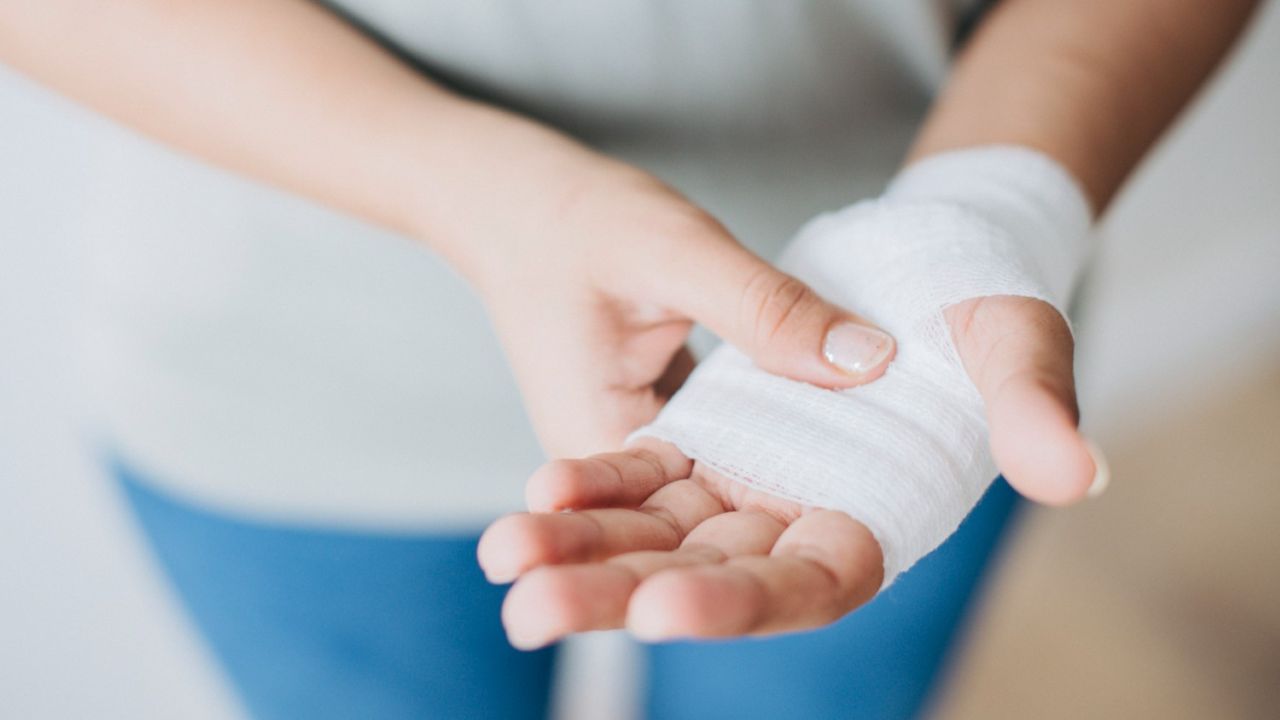 Fungsi dan Cara Pakai Wrist Splint dengan Benar