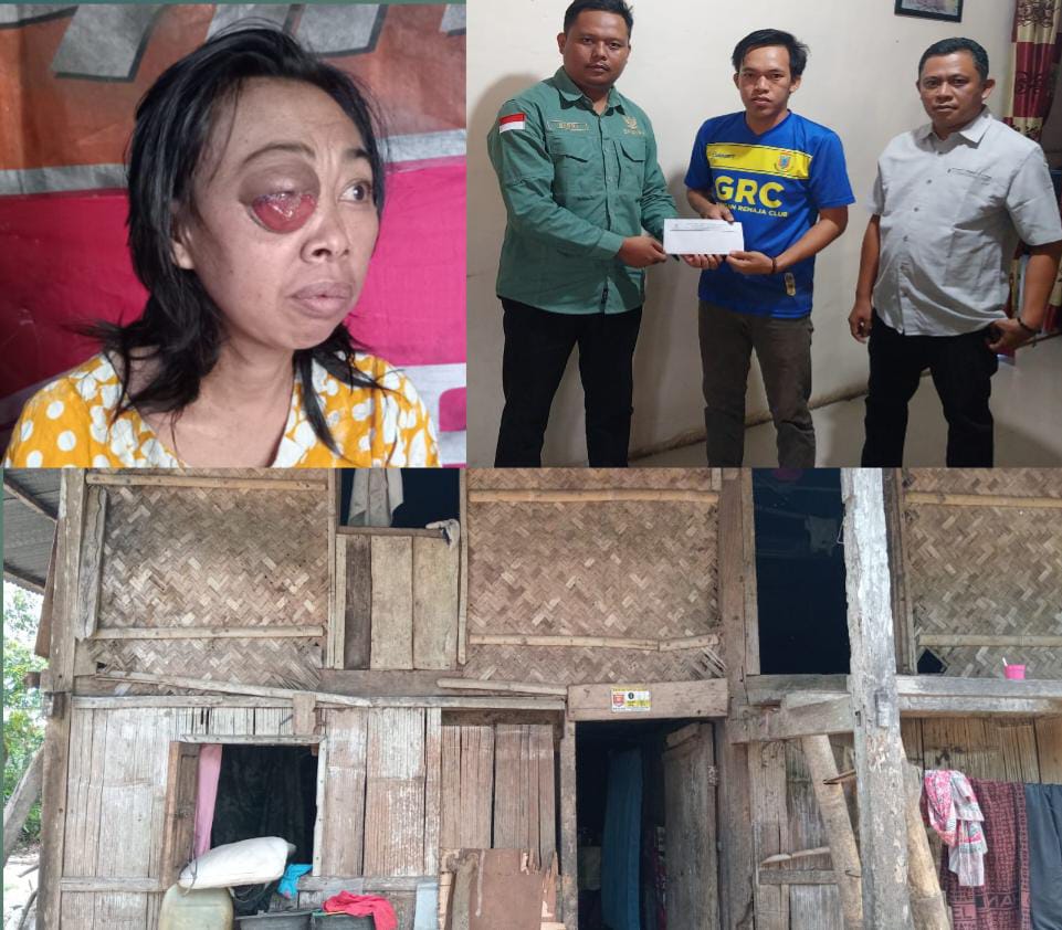 Menderita Tumor Bagian Mata, Ibu Megawati Butuh Uluran Bantuan Biaya Perjalanan Pengobatan