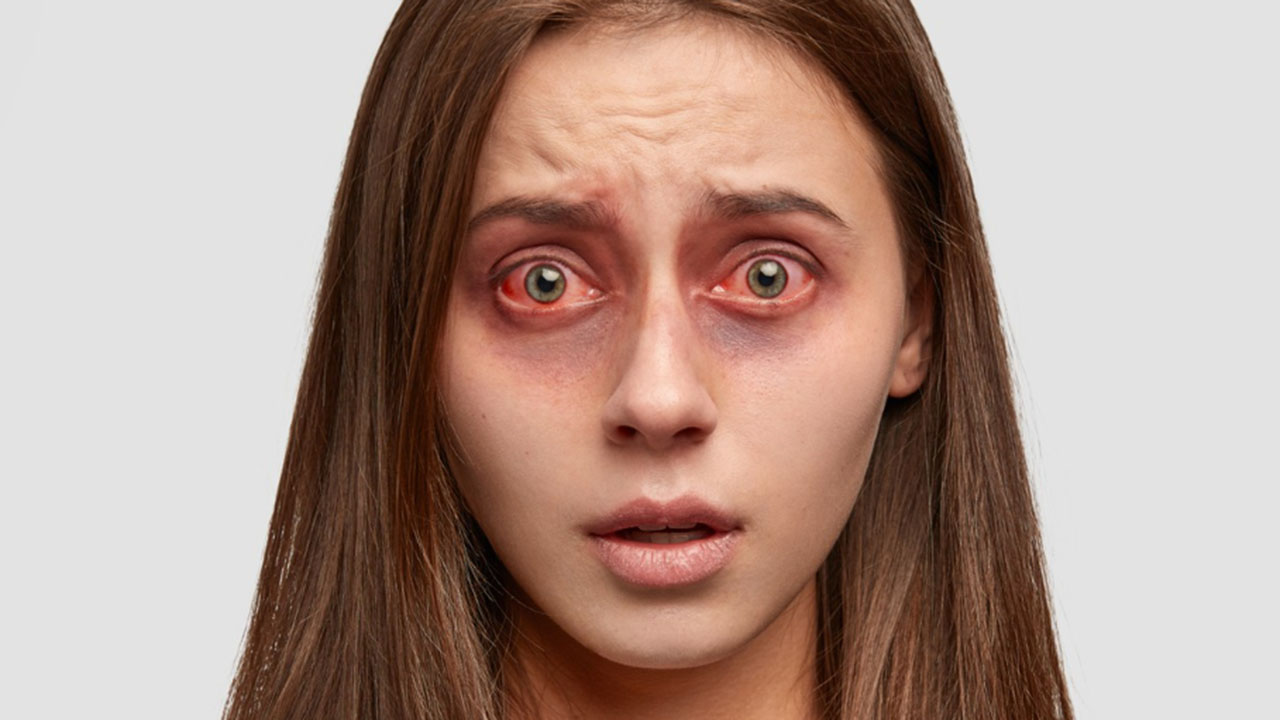 Mata Terasa Panas: Kenali Penyebab dan Solusi Efektifnya