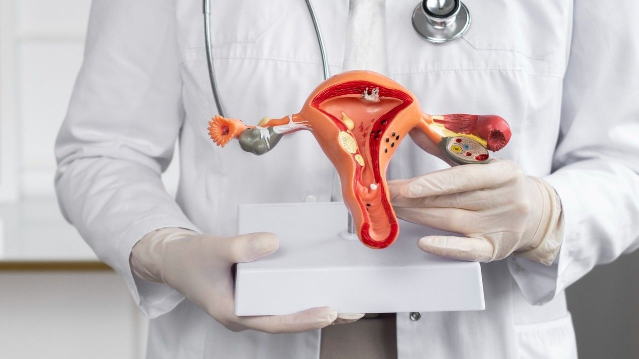 Gejala PCOS pada Remaja Putri yang Harus Dikenali