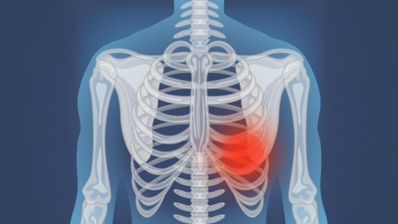 Tulang Rusuk Kiri Bawah Sakit Saat Ditekan: Kenali Penyebab dan Cara Menanganinya