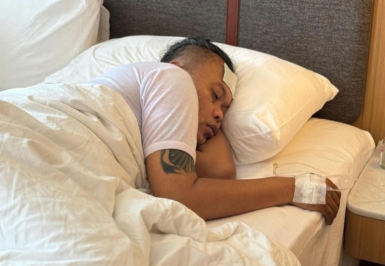 Sule Tumbang di Indramayu, Ternyata Alami Infeksi Pencernaan