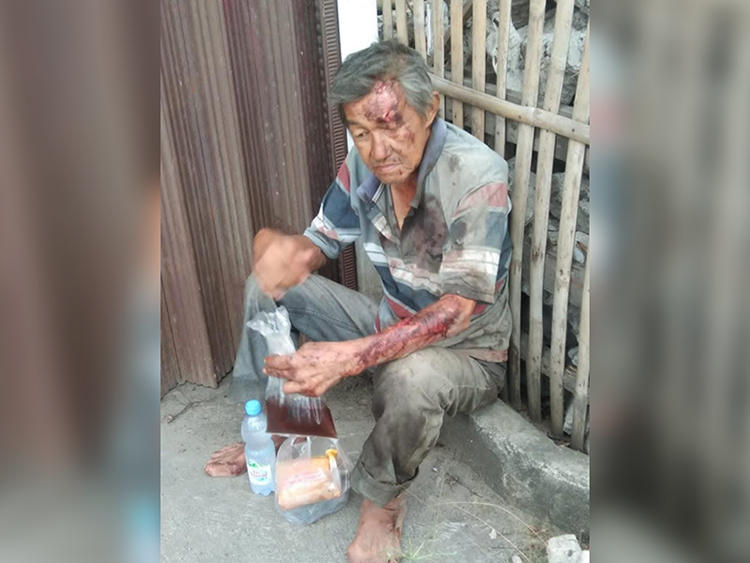 Seorang Kakek Ditemukan Terluka Parah dan Dirawat di Puskesmas Sukabumi