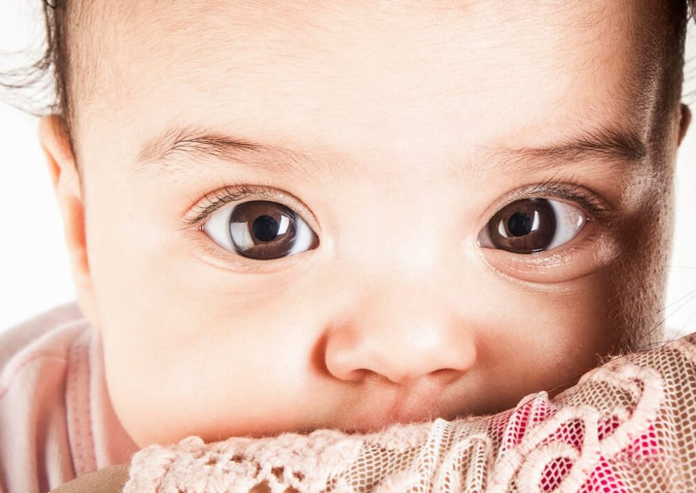 Mengenal Congenital Ptosis: Kondisi Kelopak Mata Turun Sejak Lahir pada Anak