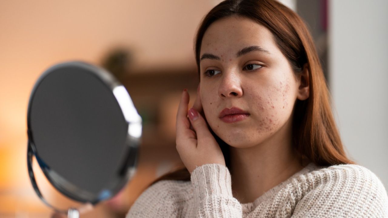 Rahasia Kulit Glowing: 10 Langkah Skincare Efektif untuk Atasi Flek dan Bekas Jerawat