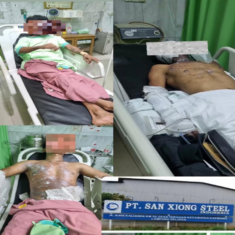 4 Karyawan PT San Xiong Steel Lampung Alami Kecelakaan Kerja, Ketua FPSBI-KSN: Sistem Produksinya Bermasalah 