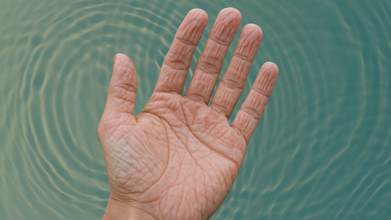 Pola Keriput Jari Usai Terendam Air Selalu Sama, Ini Penjelasannya