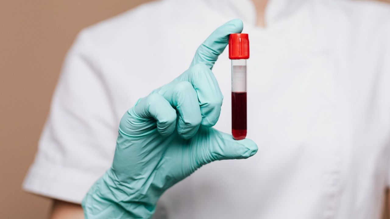 Trombosit: Fungsi Penting dan Gangguan yang Harus Diwaspadai