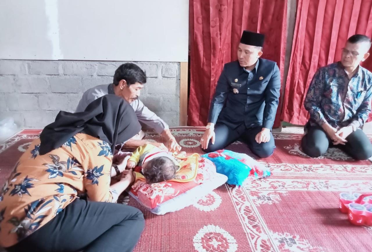 Jenguk Syarifa Balita Penderita Hidrosefalus, Bupati Parosil Beri Bantuan