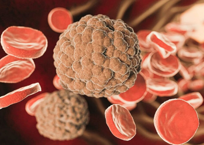 Kenapa Basofil Bisa Tinggi? Ini Penyebab dan Cara Mengatasinya