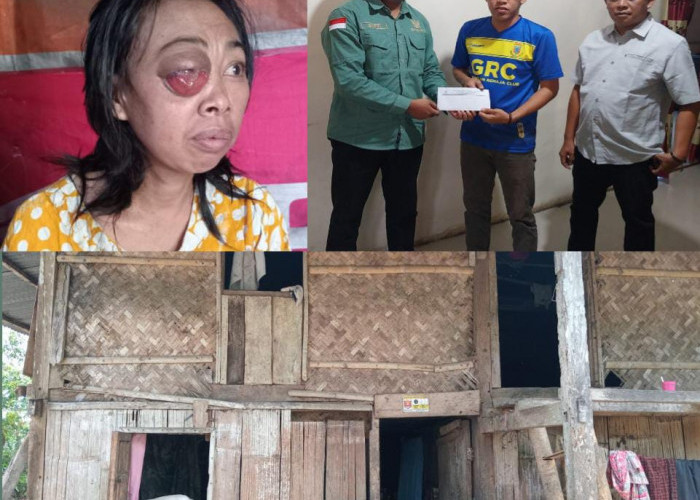 Menderita Tumor Bagian Mata, Ibu Megawati Butuh Uluran Bantuan Biaya Perjalanan Pengobatan
