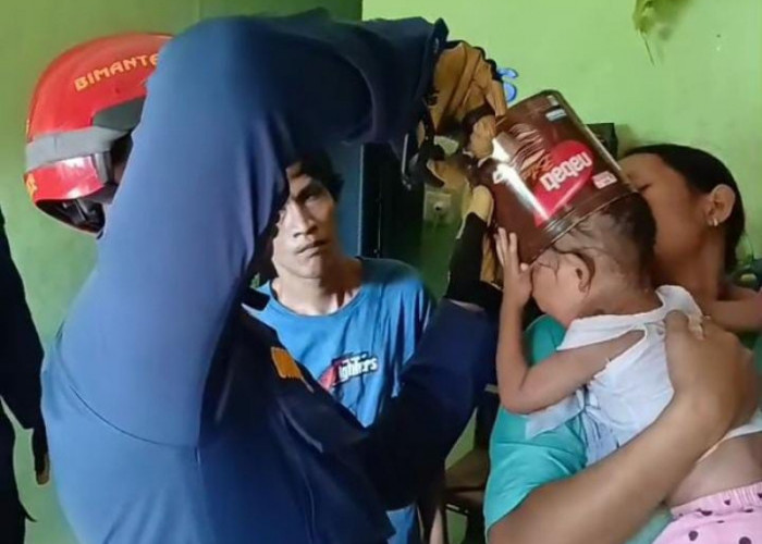 Balita di Bandar Lampung Dievakuasi Setelah Kepala Terjepit Kaleng Biskuit