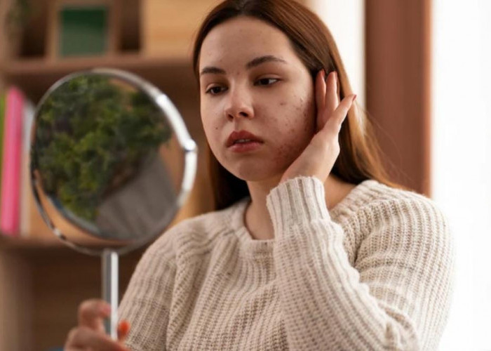 Cara Efektif Menghilangkan Bruntusan dan Mencegahnya Datang Kembali