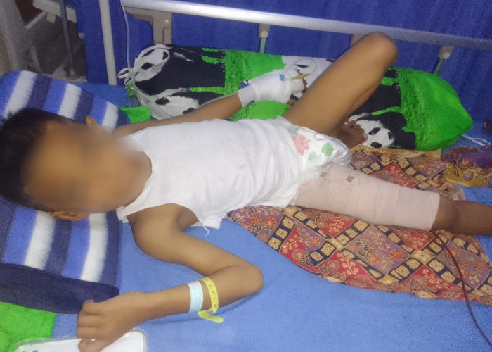 Bocah 6 Tahun di Lampung Utara Diduga Dianiaya Kerabat Hingga Patah Tulang