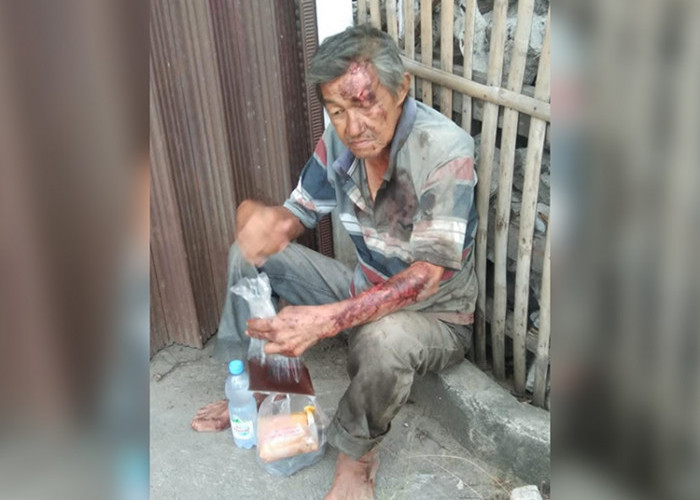 Seorang Kakek Ditemukan Terluka Parah dan Dirawat di Puskesmas Sukabumi