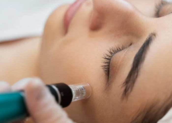 Microneedling: Cara Kerja, Manfaat, dan Hal yang Perlu Diketahui