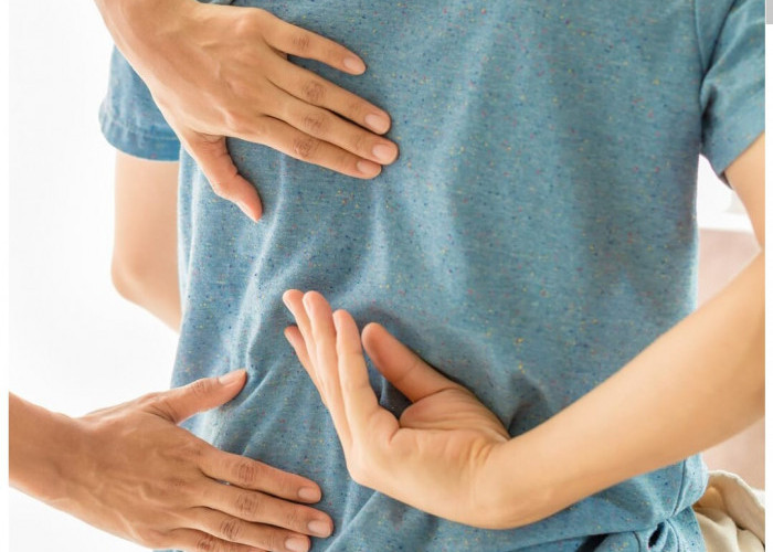 Skoliosis Bisa Sembuh? Ini Fakta Medis dan Cara Penanganannya