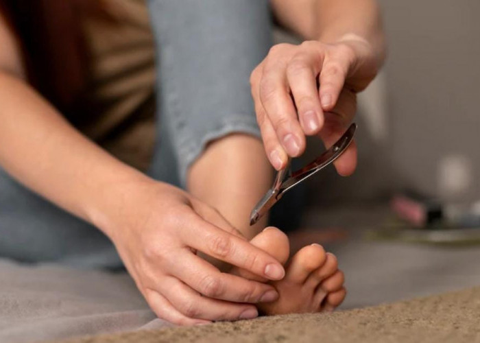 Cantengan Tak Kunjung Sembuh? Ini Cara Mengatasinya Secara Tepat dan Aman