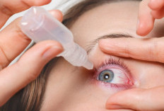 Irigasi Mata: Panduan Lengkap Membersihkan Mata dari Debu dan Iritasi Secara Aman