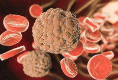 Kenapa Basofil Bisa Tinggi? Ini Penyebab dan Cara Mengatasinya