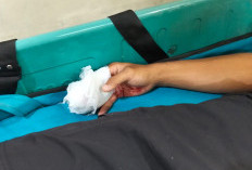 Petugas BPBD Bandar Lampung Alami Kecelakaan Saat Evakuasi Banjir, Tiga Jari Terluka Parah