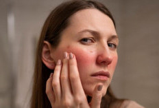 Kulit Terasa Kering dan Kasar? Ini Beragam Penyebab yang Sering Tidak Disadari