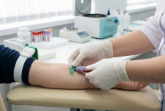 Perlukah Puasa Sebelum Cek Kolesterol? Ini Penjelasan Medisnya