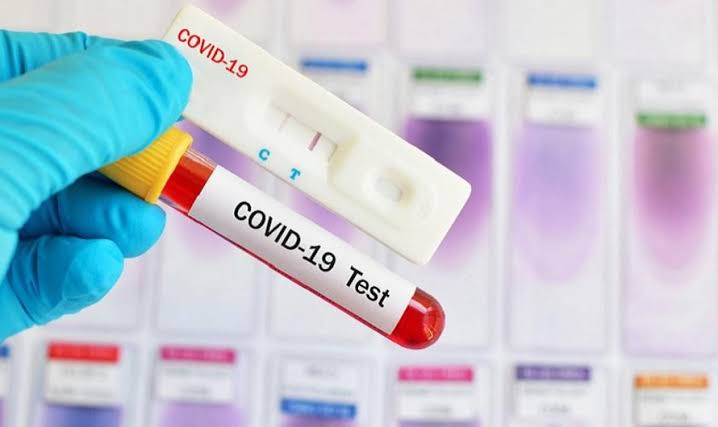 Hasil Rapid Test Warga Gihamsukamaju dan Bakhu Reaktif, Paijo: Bukan Berarti Positif Covid-19