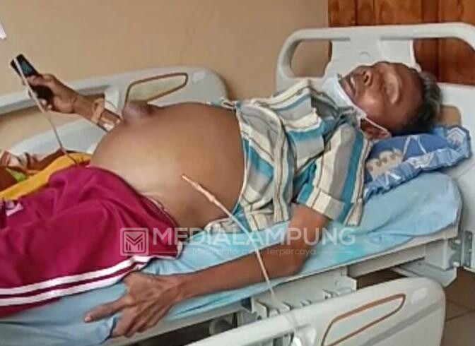 Derita Hepatitis B Hingga Perut Membesar, Rahmad Jailani Butuh Uluran Tangan Dermawan