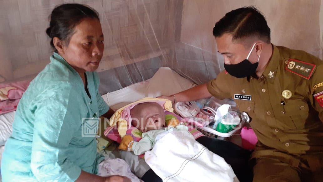 Bayi Penderita Hidrosefalus di Pekon Pahayujaya Dapat Perhatian Tim Kecamatan dan Polsek 