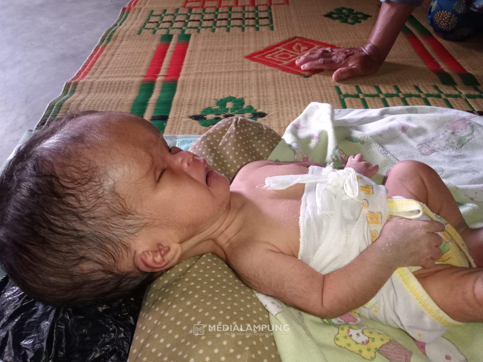 Kalvino, Bayi Penderita Hidrosefalus di Kebuntebu Menunggu Bantuan Pemerintah