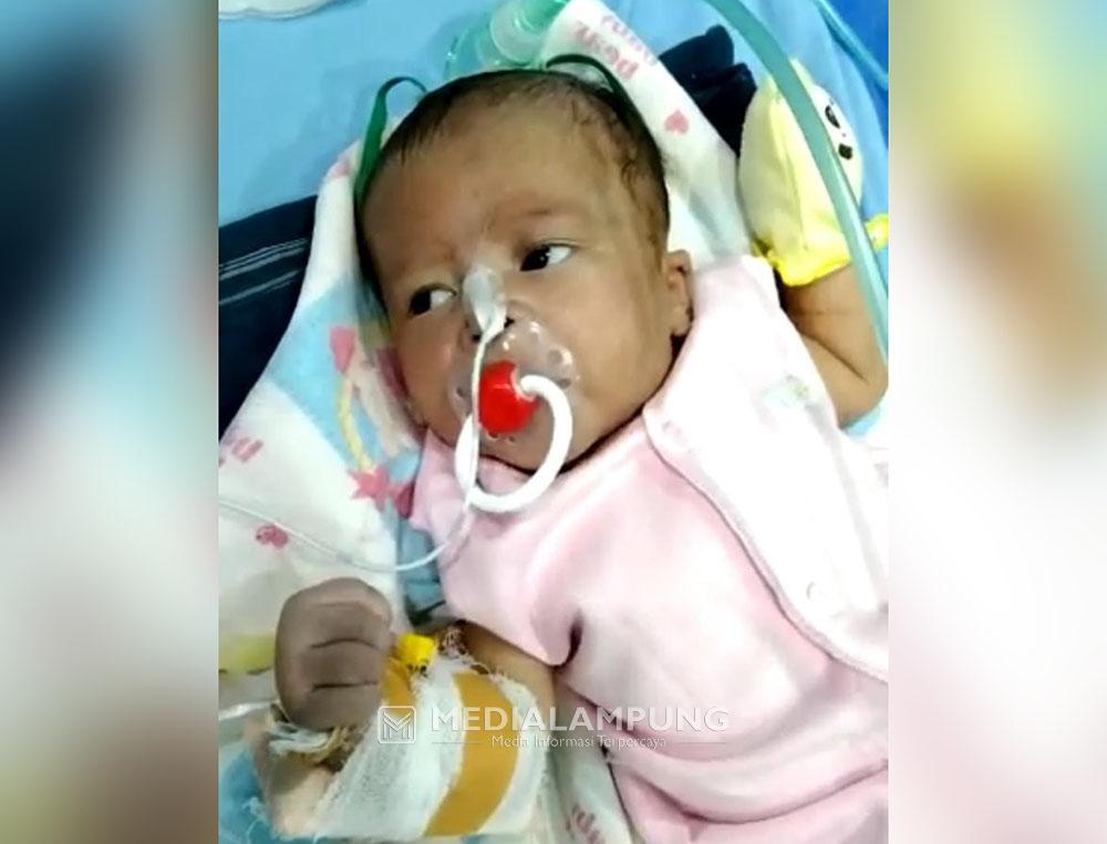 Kelainan Jantung dan Paru-Paru, Bayi Mungil Ini Butuh Uluran Tangan